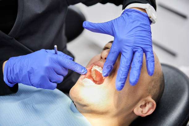 Best Emergency Dentist for Lost Fillings or Crowns in Catlettsburg, KY